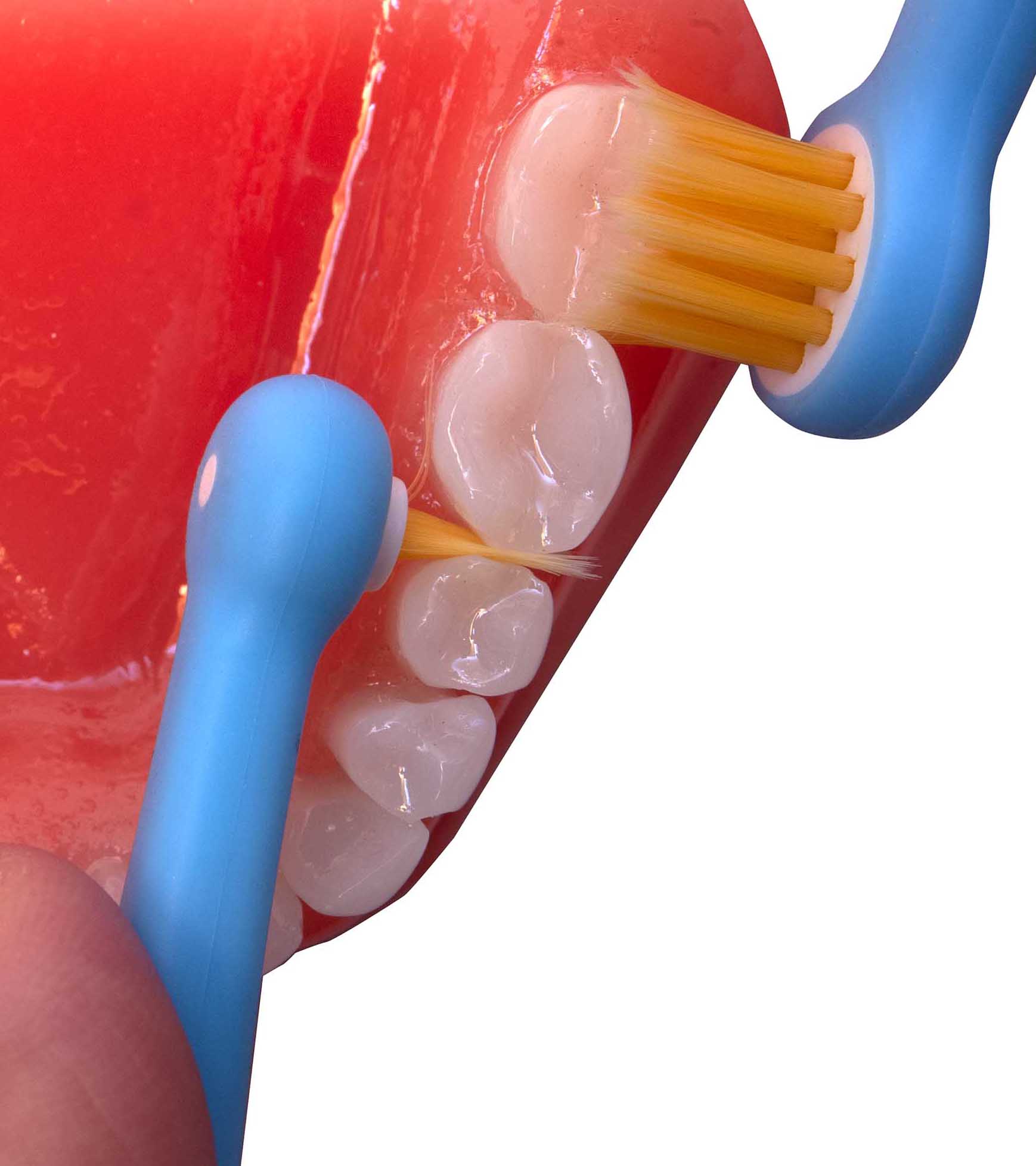 Brossage de précision des dents avec les têtes de brosse Swiss Dental Expert